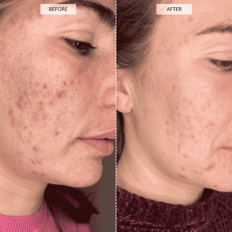CosmeticaRX RED Light Pannel